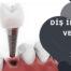 Diş İmplantı ve Diş Eti Sağlığı