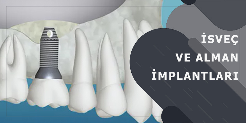 İsveç ve Alman İmplantları