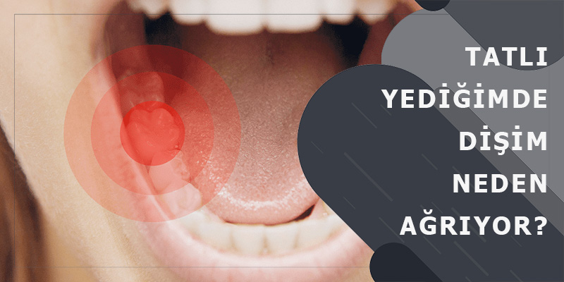 Tatlı Yediğimde Dişim Neden Ağrıyor?