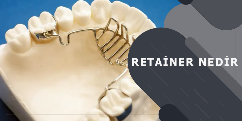 Retainer Nedir