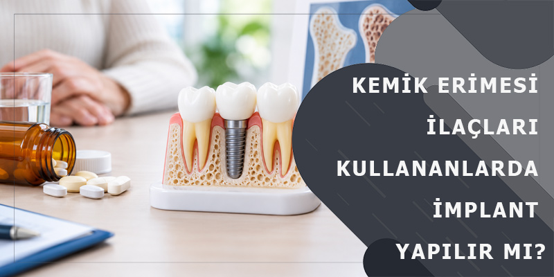 Kemik Erimesi İlaçları Kullananlarda İmplant Yapılır mı?
